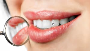 Tooth jewellery