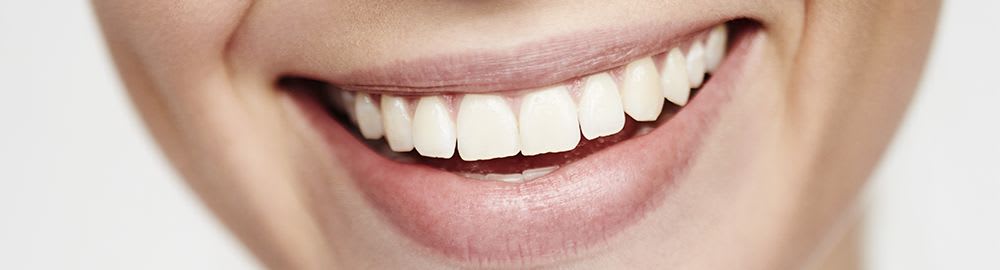 Tooth whitening