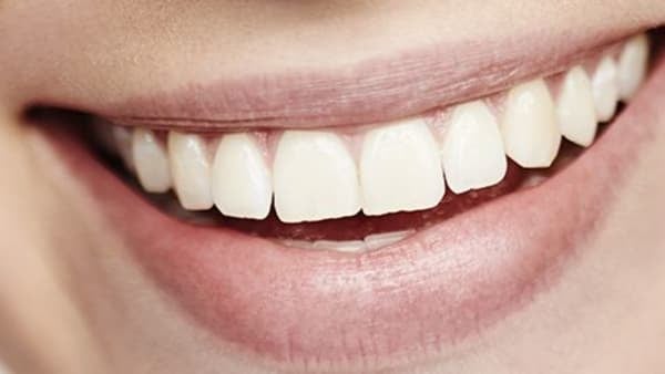 Tooth whitening