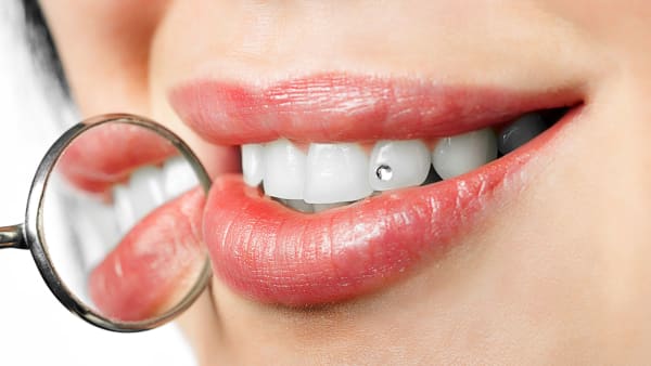 Tooth jewellery